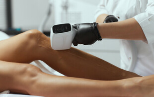 IPL Hair Removal Treatment at Ametrine Rose Health & Beauty - Option for Underarms, or incl. Standard Bikini Lines & Lower Legs